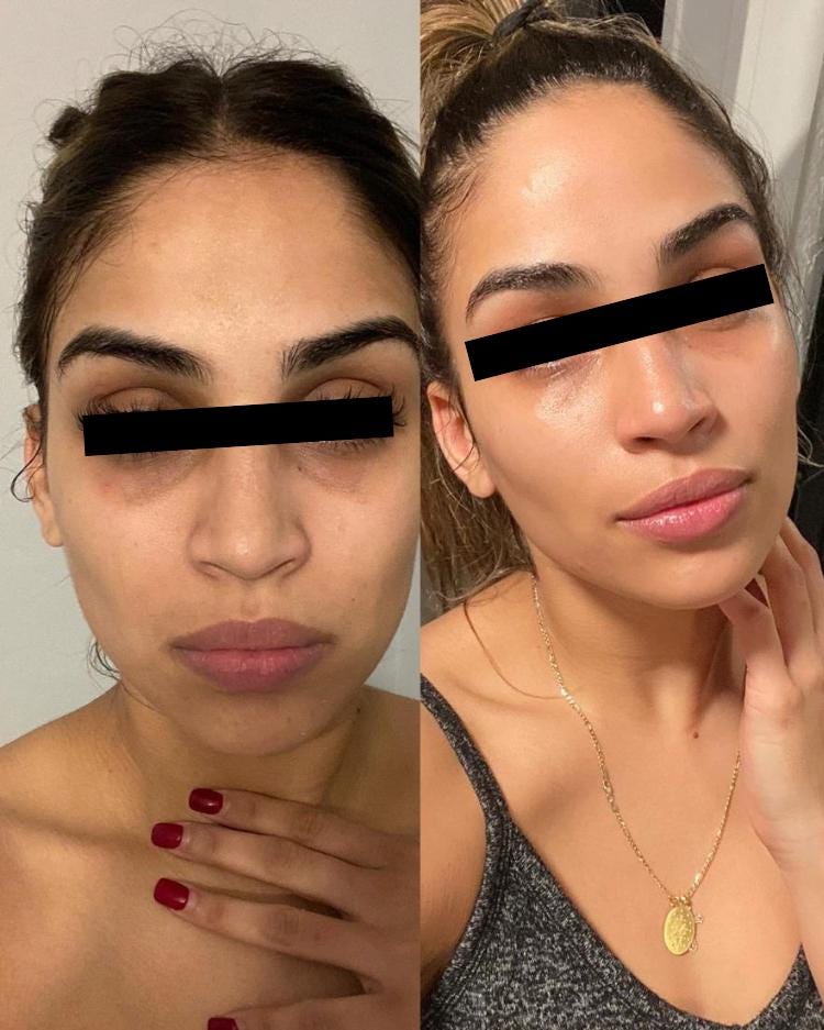 Clear Skin Glamour Magick